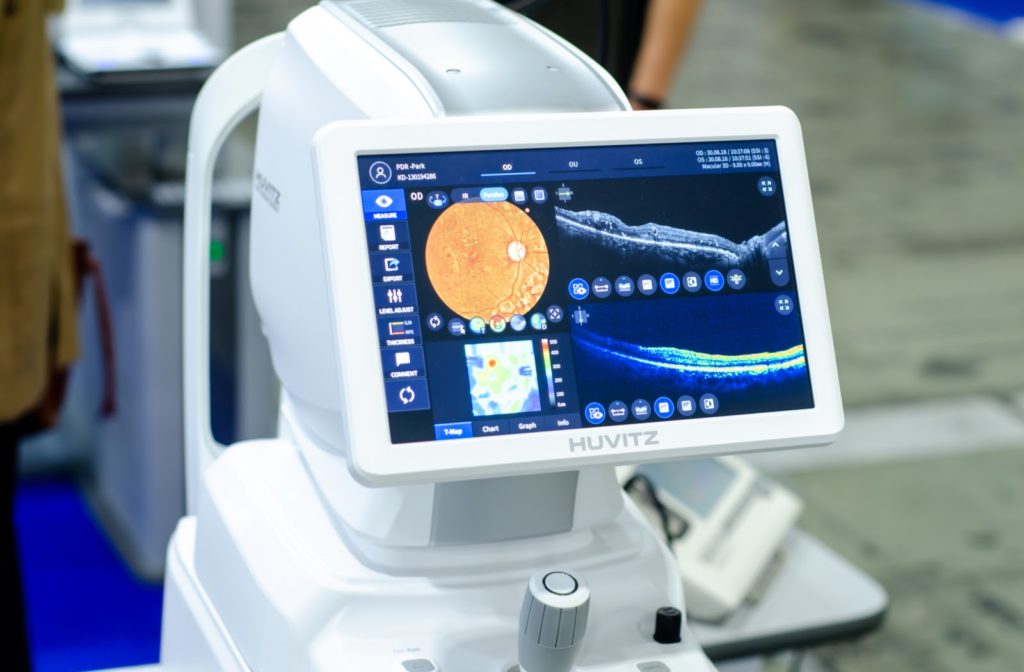 Optical Coherence Tomography used to provide an image of the retina in the back of a patient's eye